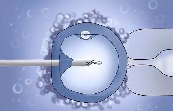 IVF