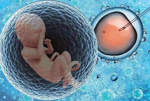 IVF