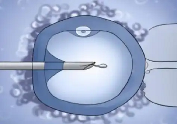 IVF