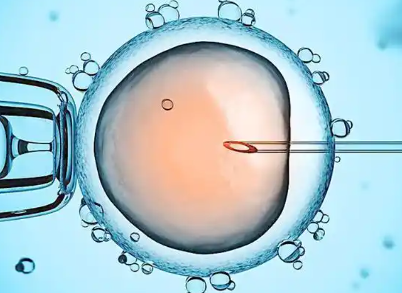 IVF