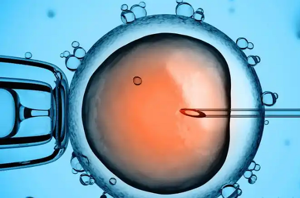 IVF
