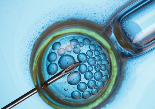 IVF