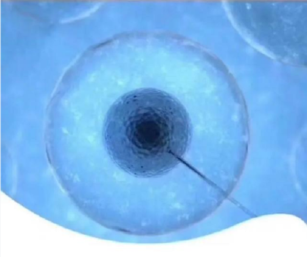 代孕